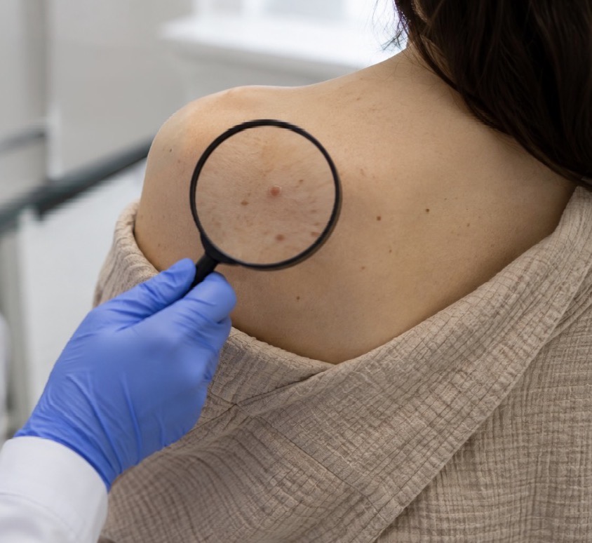 A dermatologist examining a patient's arm during a medical dermatology visit