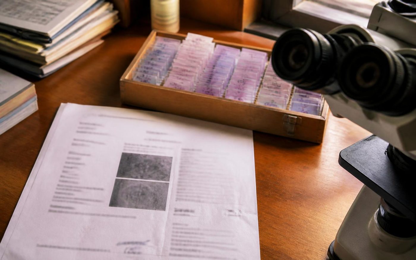 Dermatopathology slides and a pathology report beside a microscope during diagnosis review